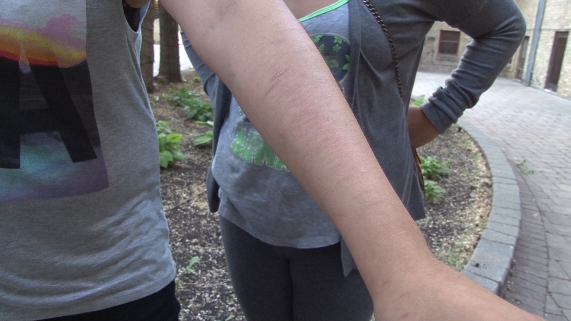 Jennifer shows self-inflicted scars on her arm where she cuts herself. The CFS ward says she's suicidal and blames the Manitoba government. 